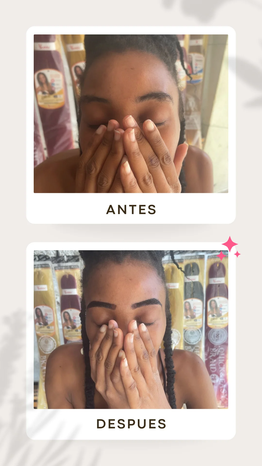 Olen Esthetic